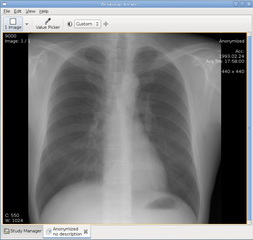 medical image viewer and DICOM network client