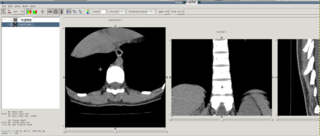 software for Medical Imaging