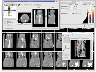 software for Medical Imaging