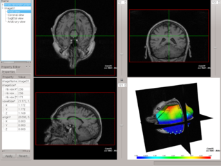 workbench application for the CamiTK library