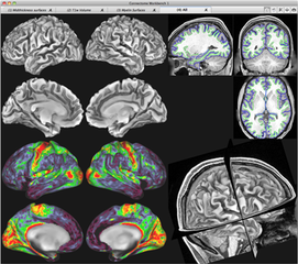 brain visualization, analysis and discovery tool