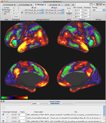 brain visualization, analysis and discovery tool