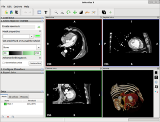 3D medical imaging reconstruction software