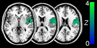 magnetic resonance image conversion, viewing and analysis