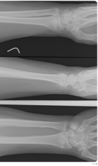 Lightweight, RESTful DICOM server for medical imaging