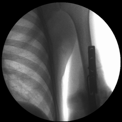 Lightweight, RESTful DICOM server for medical imaging