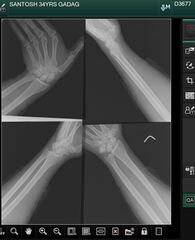 Lightweight, RESTful DICOM server for medical imaging