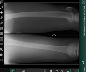 Lightweight, RESTful DICOM server for medical imaging