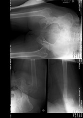 Lightweight, RESTful DICOM server for medical imaging