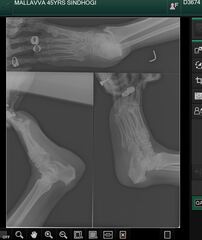 Lightweight, RESTful DICOM server for medical imaging