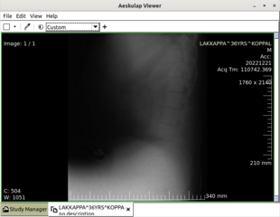 Lightweight, RESTful DICOM server for medical imaging