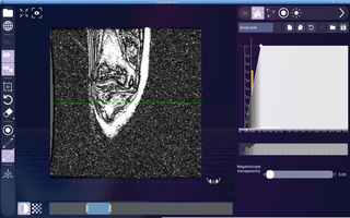 DICOM viewer