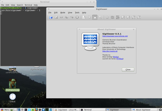 GUI viewer for biosignals such as EEG, EMG, and ECG