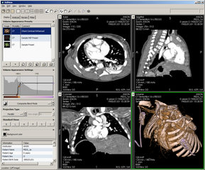 Advanced volume visualization tool