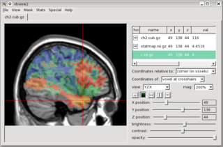 processing, statistical analysis, and display of brain imaging data