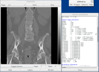 Medical Image (DICOM, ECAT, ...) conversion tool (GUI)